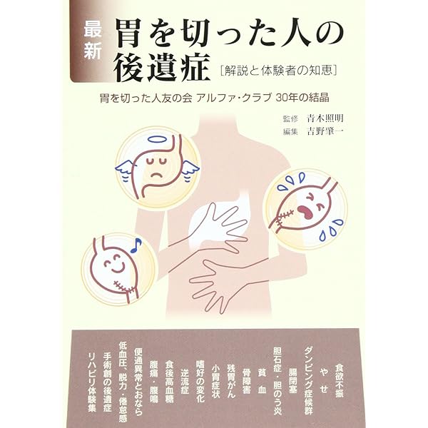 胃を切った人の体験記: 70人の手記 (協和BOOKS) | 梅田 幸雄 |本